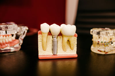 Co na zubní kámen? | Zjistěte účinné postupy